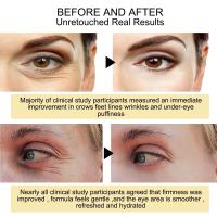 Crema Mágica para Ojos anti-Arrugas Reducción de Líneas Finas en 7 Días - details 1