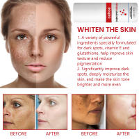 Crema Blanqueadora Efectiva para Manchas Negras Serum de Eliminación de Melasma - details 3