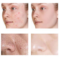 Crema para reducir los poros con ácido salicílico, crema para refinar los poros grandes, mejorar el acné facial, crema para eliminar puntos negros, Control de aceite antienvejecimiento, cuidado de la piel - details 8