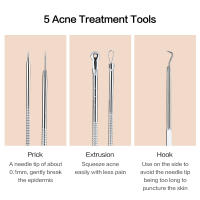 Aguja Visual inteligente para el acné, dispositivo de eliminación de acné Facial, limpieza de poros, instrumento de belleza, carga USB - details 11