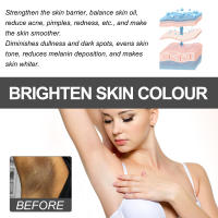 Crema Blanqueadora Hidratante y Despigmentador para Muslos Interiores, Axilas, Rodillas - details 10