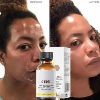 Cuidado facial Exfoliante Piel radiante Desvanece las manchas oscuras y la pigmentación para una piel aún más brillante Elimina las manchas Brazo Rodilla Piernas Melanina - details 3
