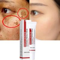Crema blanqueadora para pecas, elimina las manchas oscuras, cremas faciales antipecas, niacinamida, pigmentación que se desvanece, Melasma, ilumina el cuidado de la piel, 20g - details 0