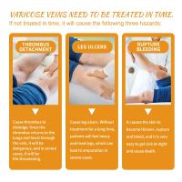 Crema para tratamiento de venas varicosas, alivia el dolor de arañas en las piernas, Vasculitis, eliminador de flebitis, ungüento reparador de vitamina K, tratamiento de relajación - details 6