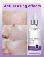 Textura de la piel |   Suero facial iluminador y retexturizante para refinar los poros con retinol y niacinamida no comedogénico - details 8