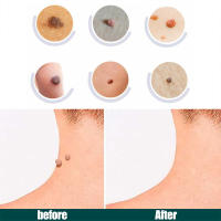Parche eliminador de etiquetas para la piel, tratamiento de verrugas, acné, granos, pegatinas absorbentes, Gel hidrocoloide, antiinfección, cuidado de la piel, 120 piezas - details 9