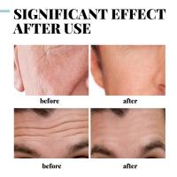 Cremas de colágeno para hombres, crema Facial antiarrugas y antienvejecimiento, crema hidratante reafirmante, crema blanqueadora de ácido hialurónico, cuidado de la piel Facial - details 2