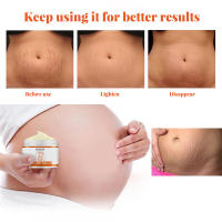 Crema que desaparece para estrías, crema reparadora antiarrugas, antienvejecimiento, tratamiento de estrías para mujeres embarazadas, crema con vitamina E para el cuidado de la piel, 50g - details 4