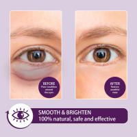 Crema para Eliminar Ojeras Instantánea Reducción de Partículas de Grasa, Desvanecimiento de Líneas Finas, Levantamiento para Belleza Coreana - details 6