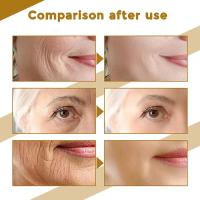 Suero Facial Centella Asiatica que nutre la piel seca, rejuvenece la piel, crema blanqueadora, crema hidratante Facial coreana - details 4