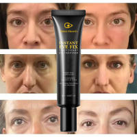 Crema para los Ojos Elimina Ojeras, Ajusta, Levanta y Reafirma Haz More Vibrante tu Mirada - details 3