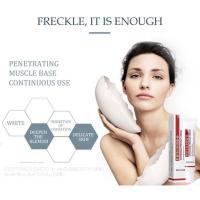 Crema blanqueadora para pecas, elimina las manchas oscuras, cremas faciales antipecas, niacinamida, pigmentación que se desvanece, Melasma, ilumina el cuidado de la piel, 20g - details 2