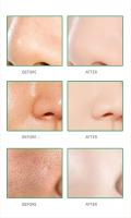 Crema para reducir los poros con ácido salicílico, crema para refinar los poros grandes, mejorar el acné facial, crema para eliminar puntos negros, Control de aceite antienvejecimiento, cuidado de la piel - details 9