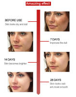 Crema Blanqueadora Efectiva para Manchas Negras Serum de Eliminación de Melasma - details 10
