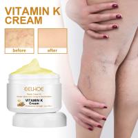 Crema para tratamiento de venas varicosas, alivia el dolor de arañas en las piernas, Vasculitis, eliminador de flebitis, ungüento reparador de vitamina K, tratamiento de relajación - details 0