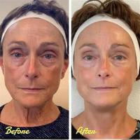 Crema para los Ojos Elimina Ojeras, Ajusta, Levanta y Reafirma Haz More Vibrante tu Mirada - details 2