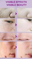 Textura de la piel |   Suero facial iluminador y retexturizante para refinar los poros con retinol y niacinamida no comedogénico - details 6