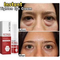 Crema para Eliminar Ojeras Instantánea Reducción de Partículas de Grasa, Desvanecimiento de Líneas Finas, Levantamiento para Belleza Coreana - details 3