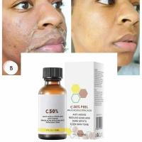 Cuidado facial Exfoliante Piel radiante Desvanece las manchas oscuras y la pigmentación para una piel aún más brillante Elimina las manchas Brazo Rodilla Piernas Melanina - details 1