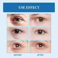 Crema para los Ojos Hidratante y Anti-arrugas Masajeador de Rolos para Cuidado de la Piel - details 6