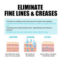 Serum para los Ojos EELHOE Eliminación de Ojeras, Reafirmación y Estirado Crema Antarrea - details 7