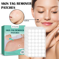Parche eliminador de etiquetas para la piel, tratamiento de verrugas, acné, granos, pegatinas absorbentes, Gel hidrocoloide, antiinfección, cuidado de la piel, 120 piezas - details 1