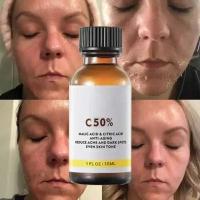 Cuidado facial Exfoliante Piel radiante Desvanece las manchas oscuras y la pigmentación para una piel aún más brillante Elimina las manchas Brazo Rodilla Piernas Melanina - details 2