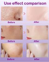 Textura de la piel |   Suero facial iluminador y retexturizante para refinar los poros con retinol y niacinamida no comedogénico - details 3