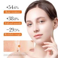 Crema Facial de Retinol Anti-arrugas, Anti-envejecimiento, Hidratante, Ácido Hidrocolónico, Vitamina C Herramienta de Cuidado de la Piel para Blanqueo Facial - details 6