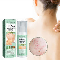 Spray para tratamiento del acné en la espalda, eliminación de manchas, suero, Control de aceite, reduce los poros, hidratante, ácido salicílico, cuidado de la piel - details 1