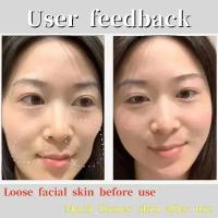 Mascarilla de Nutrición Profunda para Reafirmar la Piel Facial Parche Hidrocristalino Anti-Envejecimiento Lifting para Estomación - details 6