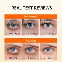 Sérum para Ojos de Retinol Cuidado de Piel Firmador Anti-Círculos Blanqueo de Líneas Finas - details 2