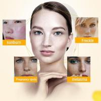 Crema blanqueadora para pecas, elimina las manchas oscuras, cremas faciales antipecas, niacinamida, pigmentación que se desvanece, Melasma, ilumina el cuidado de la piel, 20g - details 3