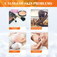 Crema facial blanqueadora de pecas, Corrector de manchas solares de día y noche de Papaya, pigmento que se desvanece, ilumina el tono de la piel, blanquea las imperfecciones, nutritiva - details 5