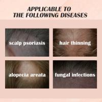 Esencia para tratamiento del cuero cabelludo, tratamiento anticaspa para psoriasis, alivia la descamación, la picazón, potenciador de folículos, suero nutritivo para el cabello - details 6