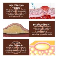 Crema calmante para el cuidado de la piel, eliminador de bultos subcutáneos, alivia la aglomeración corporal, bloques duros, crema para el cuidado de la piel del cuerpo - details 12