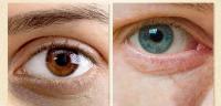 Crema Mágica para Ojos anti-Arrugas Reducción de Líneas Finas en 7 Días - details 7