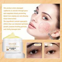 Crema para tratamiento de venas varicosas, alivia el dolor de arañas en las piernas, Vasculitis, eliminador de flebitis, ungüento reparador de vitamina K, tratamiento de relajación - details 8