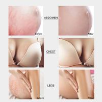 Crema eliminadora de estrías, elimina cicatrices de embarazo, reparación de maternidad, antiarrugas, reafirmante de la piel - details 1
