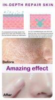 Textura de la piel |   Suero facial iluminador y retexturizante para refinar los poros con retinol y niacinamida no comedogénico - details 9
