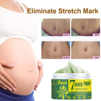 Elimina las cicatrices del embarazo, crema para el acné, tratamiento de estrías, reparación de maternidad, 7 días posparto, obesidad, cuidado de la piel seguro para la salud corporal - details 2