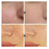 Crema para reducir los poros con ácido salicílico, crema para refinar los poros grandes, mejorar el acné facial, crema para eliminar puntos negros, Control de aceite antienvejecimiento, cuidado de la piel - details 2