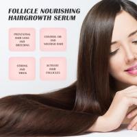 Esencia para tratamiento del cuero cabelludo, tratamiento anticaspa para psoriasis, alivia la descamación, la picazón, potenciador de folículos, suero nutritivo para el cabello - details 10