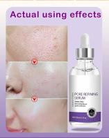 Textura de la piel |   Suero facial iluminador y retexturizante para refinar los poros con retinol y niacinamida no comedogénico - details 8