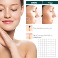 Parche eliminador de etiquetas para la piel, tratamiento de verrugas, acné, granos, pegatinas absorbentes, Gel hidrocoloide, antiinfección, cuidado de la piel, 120 piezas - details 6