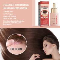 Esencia para tratamiento del cuero cabelludo, tratamiento anticaspa para psoriasis, alivia la descamación, la picazón, potenciador de folículos, suero nutritivo para el cabello - details 4
