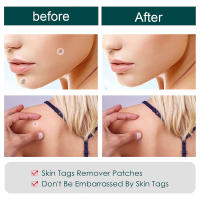Parche eliminador de etiquetas para la piel, tratamiento de verrugas, acné, granos, pegatinas absorbentes, Gel hidrocoloide, antiinfección, cuidado de la piel, 120 piezas - details 7