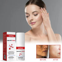 Crema Blanqueadora Efectiva para Manchas Negras Serum de Eliminación de Melasma - details 0