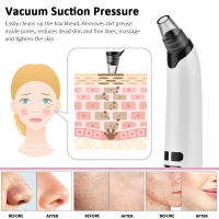 Eliminador de Espinillas Eléctrico Negro Limpieza Facial Agua Ciclo Succión Pore Acné Limpiador Punto Negro Eliminación Exfoliantes para Piel Normal - details 2