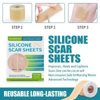 Cinta De Reparación De Marcas Silicone Gen 1 Para Rostro Y Cuerpo Eliminación De Acné Cuidado De La Piel Sin Electricity - details 8